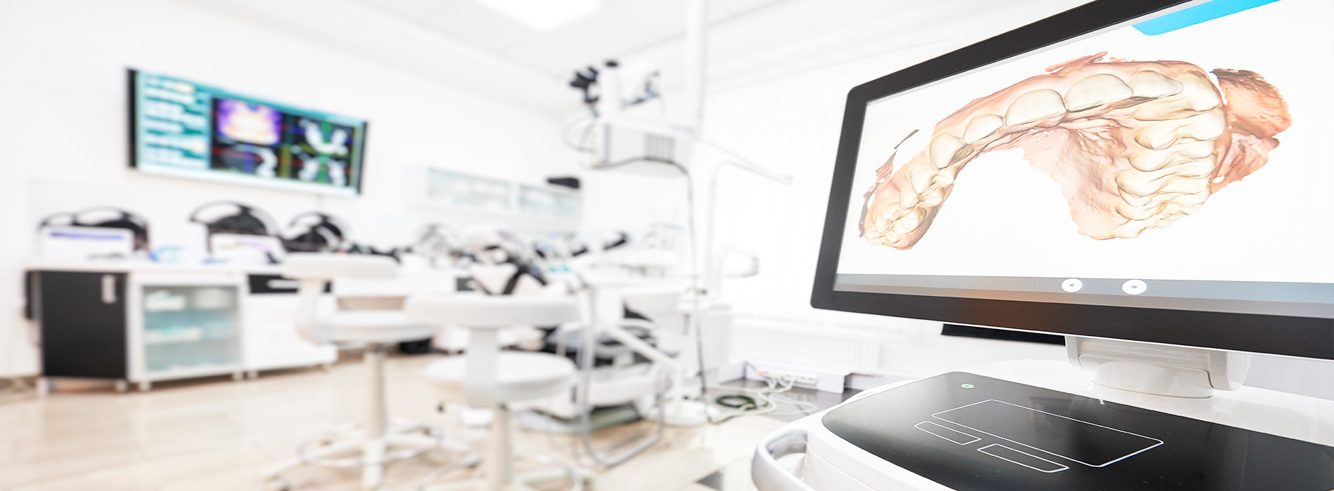 3D medical model on a computer screen in a dental office setting.