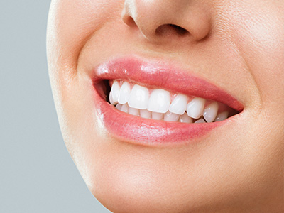 The image shows a close-up of a person s face, smiling with straight white teeth.